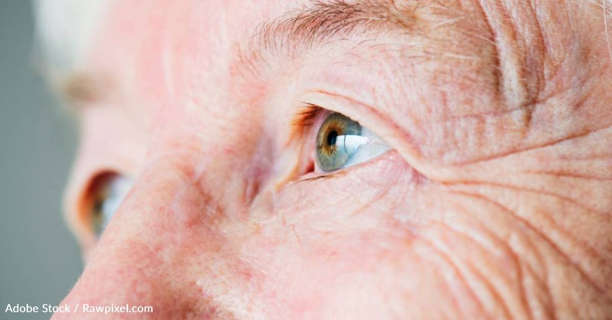 Retina Damage Linked with Alzheimer's